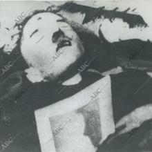 Fotografía de Hitler muerto realizada por su médico personal